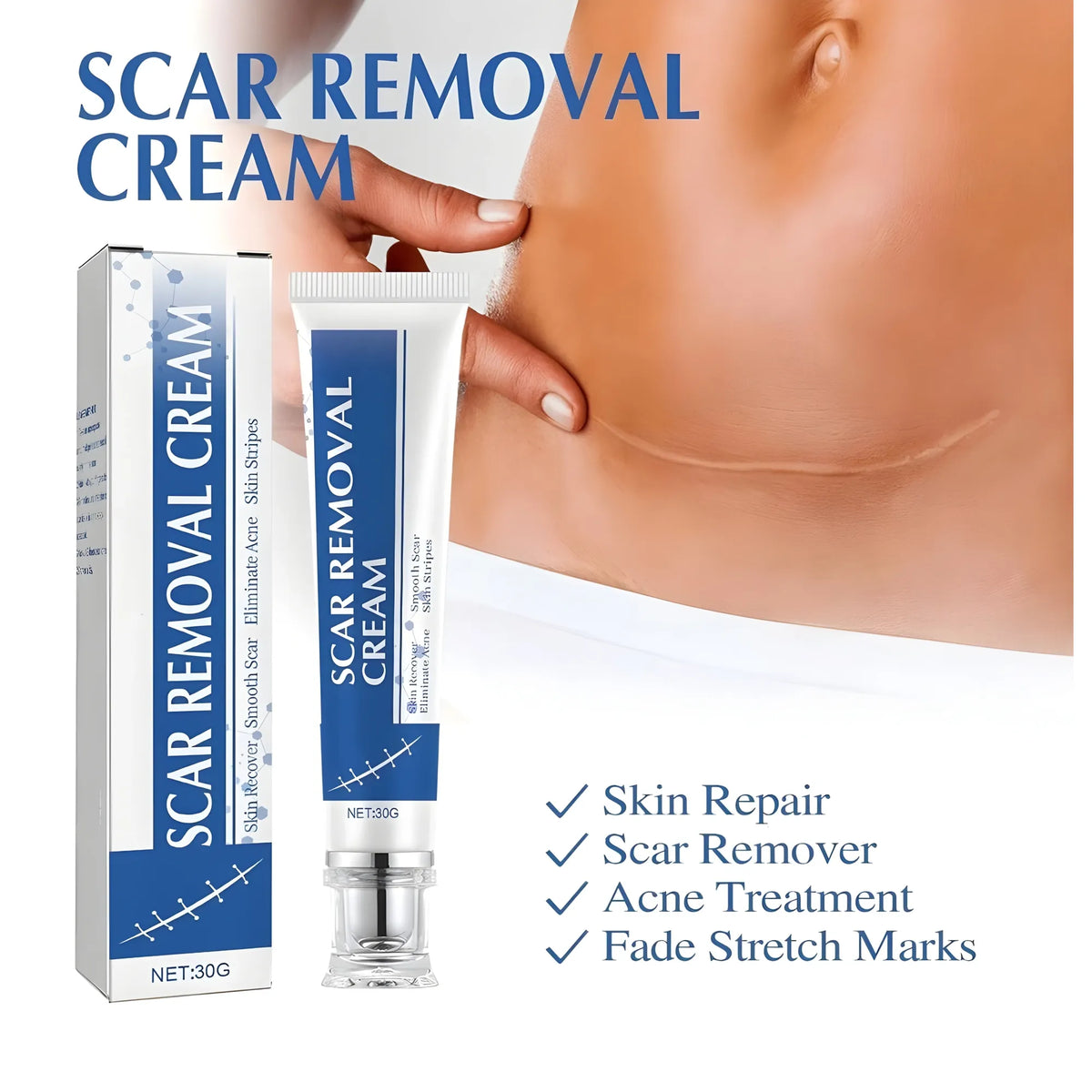 Plastic Scar Removal Cream (White-Blue)
